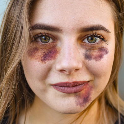 Black Eye/Bruises Temporary Tattoo (Set of 3)