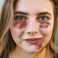 Black Eye/Bruises Temporary Tattoo (Set of 3)