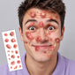 Nasty Large Boils Temporary Tattoo SET