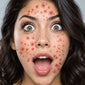 Pimples FX Temporary Tattoo Set